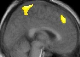 I win, you lose: Brain imaging reveals how we learn from our competitors