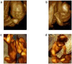 Twin fetuses learn how to be social in the womb