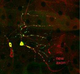 Key protein discovered that allows nerve cells to repair themselves