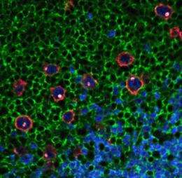Multicolor quantum dots aid in cancer biopsy diagnosis