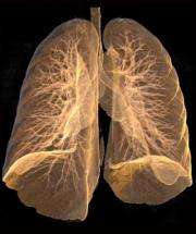 New test could identify smokers at risk of emphysema