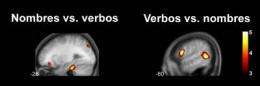 Nouns and verbs are learned in different parts of the brain