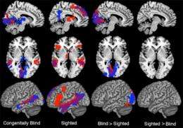 Parts of brain can switch functions: study