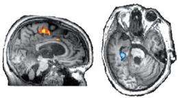 Patient presumed vegetative communicates via brain scan: study