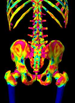 Predicting fracture risk with new imaging technology