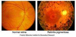 Researchers look to the future for defeating blindness