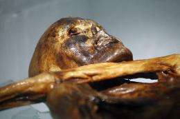 The mummy of an iceman named Otzi