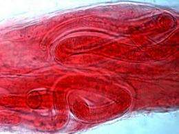 Trichinosis parasite gets DNA decoded