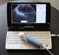 Undergraduates' low-cost ultrasound system wins Gates Foundation grant