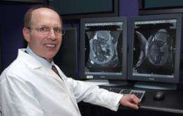 Unusual prenatal MRI detects rare, oft-missed genetic disease