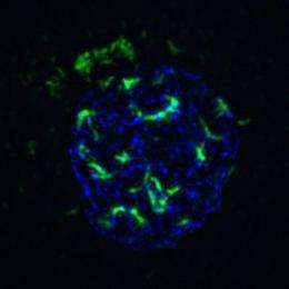 Use the common cold virus to target and disrupt cancer cells?