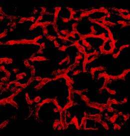 Defective signaling pathway leads to vascular malformations in the brain