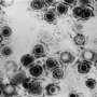 Study identifies new way to attack herpesviruses