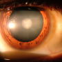 AI to improve cataract surgery in the Global South