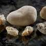 new research in kidney stones