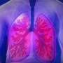 research paper on cystic fibrosis