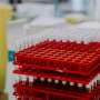 Oxford-AstraZeneca COVID-19 vaccine protection wanes after three months, study suggests thumbnail