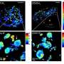 Researchers magnify hidden biological structures by combining SRS and expansion microscopy