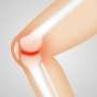 case study rheumatoid arthritis quizlet