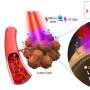 Light-controlled 'drug-free' macromolecules for precise tumor therapy thumbnail