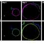 Optical imaging highlights metabolic interactions that make pancreatic tumor cells grow thumbnail