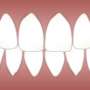 for research purposes prevalence of periodontal disease means
