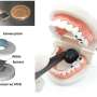 Ultrathin dental camera inspired by insect-eye structure