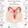 Four novel receptors may link endometrial cancer to PCOS