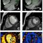 Imaging the adolescent heart provides 'normal' reference values for clinical practice thumbnail