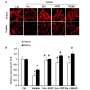 Membrane raft redox signaling contributes to visfatin-induced inflammation and kidney damage: Study thumbnail