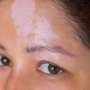 recent research in vitiligo