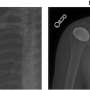 Deep learning enables faster, more accurate decisions for treatment of
shoulder abnormalities