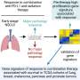 Genetic signature may predict response to immunotherapy for non-small
cell lung cancer