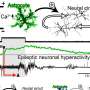 Researchers discover glial hyper-drive for triggering epileptic seizures