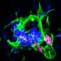 latest research on metastatic prostate cancer