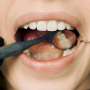 Healthy teeth are wondrous and priceless: Dentist explains why and how best to protect them