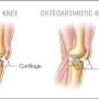 new orthopaedic research topics